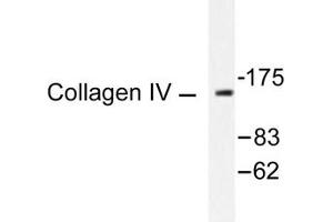 Image no. 1 for anti-Collagen, Type IV (COL4) antibody (ABIN265367) (Collagen IV Antikörper)