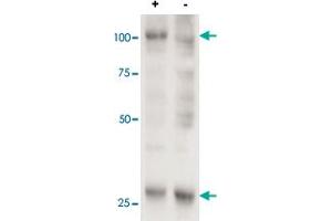 Cell line 143B overexpressing human AARS2 and probed with AARS2 polyclonal antibody  (mock transfection in second lane). (AARS2 Antikörper  (AA 478-489))