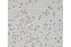 Immunohistochemistry of paraffin-embedded Mouse brain using RPL3 Polyclonal Antibody at dilution of 1:100 (40x lens). (RPL3 Antikörper)
