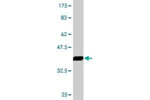 Western Blot detection against Immunogen (44. (AGR2 Antikörper  (AA 1-175))