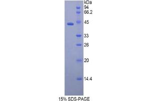SDS-PAGE analysis of Rat CAMP Protein. (Cathelicidin Antimicrobial Peptide (CAMP) Peptid)
