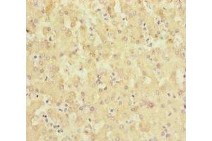 Immunohistochemistry of paraffin-embedded human liver tissue using ABIN7169946 at dilution of 1:100 (SLC6A12 Antikörper  (AA 515-614))