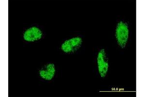 Immunofluorescence of monoclonal antibody to SH2B1 on HeLa cell.