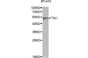 Western blot analysis of extracts of BT-474 cells, using TIA1 antibody.