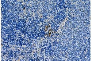 ABIN6260479 and ABIN6268964 at 1/100 staining Rat spleen tissue by IHC-P.