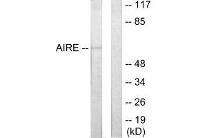 Western blot analysis of extracts from 293 cells, using AIRE antibody. (AIRE Antikörper  (Internal Region))