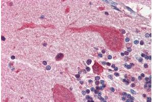 Human Brain, Cerebellum (formalin-fixed, paraffin-embedded) stained with Heat Shock Protein 90 (HSP90) antibody ABIN364328 at 5 ug/ml followed by biotinylated anti-mouse IgG secondary antibody ABIN481714, alkaline phosphatase-streptavidin and chromogen. (HSP90 Antikörper  (AA 1-732))