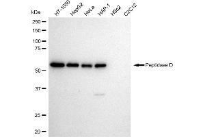 Western blotting analysis using Peptidase D antibody (ABIN7799755). (Rekombinanter PEPD Antikörper)