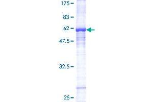 Image no. 1 for Peroxisome Proliferator-Activated Receptor alpha (PPARA) (AA 1-258) protein (GST tag) (ABIN1315830) (PPARA Protein (AA 1-258) (GST tag))