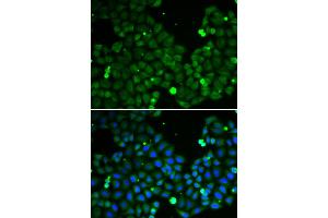 Immunofluorescence analysis of A549 cells using HIF1AN antibody (ABIN5973179). (HIF1AN Antikörper)