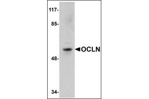 Western blot analysis of OCLN in human liver tissue lysate with this product at 1 μg/ml.