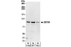 Western Blotting (WB) image for anti-Zinc Finger and BTB Domain Containing 5 (ZBTB5) (AA 200-250) antibody (ABIN7450924)