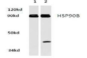 Image no. 2 for anti-Heat Shock Protein 90kDa alpha (Cytosolic), Class B Member 1 (HSP90AB1) antibody (ABIN265474) (HSP90AB1 Antikörper)