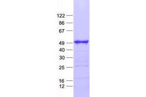 Validation with Western Blot (ZBP1 Protein (His tag))
