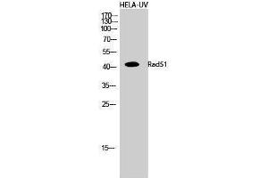 Western Blotting (WB) image for anti-DNA Repair Protein Homolog 1 (RAD51) (Thr555) antibody (ABIN3186658) (RAD51 Antikörper  (Thr555))