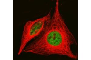 IF analysis of KAT1/HAT1 using anti-KAT1/HAT1 antibody (ABIN7603224) and anti-Tubulin Alpha antibody (ABIN7600339).