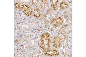 Immunohistochemical staining of human kidney with STX7 polyclonal antibody  shows strong luminal membranous and cytoplasmic positivity in cells in tubules at 1:50-1:200 dilution. (Syntaxin 7 Antikörper)