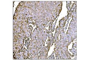 IHC analysis of HCCS using anti-HCCS antibody (ABIN7602424). (HCCS Antikörper  (AA 76-268))