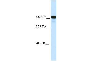 C2TA antibody used at 0. (CIITA Antikörper  (C-Term))