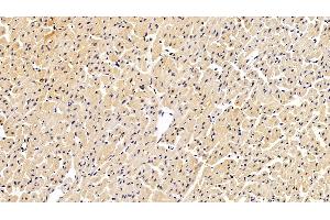 Immunohistochemistry (IHC) image for anti-S100 Calcium Binding Protein A6 (S100A6) (AA 1-90) antibody (ABIN7434041)
