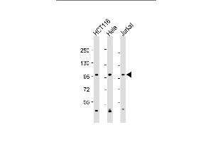 All lanes : Anti-NBA Antibody (C-Term) at 1:2000 dilution Lane 1: HC whole cell lysate Lane 2: Hela whole cell lysate Lane 3: Jurkat whole cell lysate Lysates/proteins at 20 μg per lane. (MANBA Antikörper  (AA 712-745))