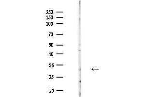 anti-Solute Carrier Family 30 Member 2 (SLC30A2) (Internal Region) antibody