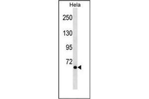 Western blot analysis of NCoA-4 Antibody (C-term) in Hela cell line lysates (35ug/lane). (NCOA4 Antikörper  (C-Term))