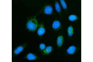 IF analysis of GHITM using anti-GHITM antibody (ABIN7599294). (GHITM Antikörper  (AA 1-345))