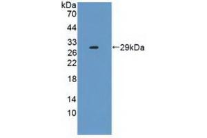 Western blot analysis of recombinant Human IL2Ra. (CD25 Antikörper  (AA 22-213))
