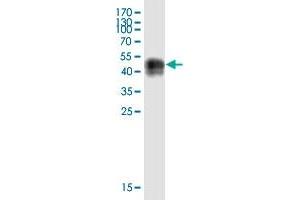 Western Blot detection against Immunogen (43. (PRAP1 Antikörper  (AA 1-151))