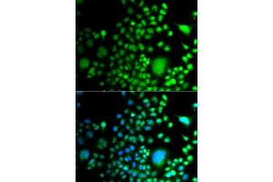 Immunofluorescence analysis of A549 cells using PAX6 antibody. (PAX6 Antikörper  (AA 1-300))