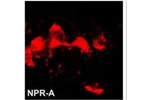 Image no. 1 for anti-Natriuretic Peptide Receptor A/guanylate Cyclase A (Atrionatriuretic Peptide Receptor A) (NPR1) (N-Term) antibody (ABIN360587) (NPR1 Antikörper  (N-Term))