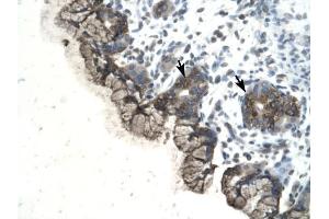PARP3 antibody was used for immunohistochemistry at a concentration of 4-8 ug/ml to stain Epithelial cells of fundic glands (arrows) in Human Stomach.