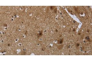 Immunohistochemistry of paraffin-embedded Human brain tissue using CD236 Polyclonal Antibody at dilution 1:60