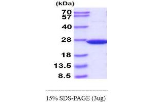 SDS-PAGE (SDS) image for Superoxide Dismutase 2, Mitochondrial (SOD2) (AA 25-222) protein (His tag) (ABIN666966)
