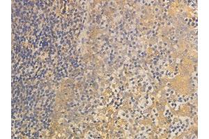 ABIN6257396 and ABIN6275332 at 1/100 staining human normal tonsil tissue by IHC-P. (OGFR Antikörper  (Internal Region))