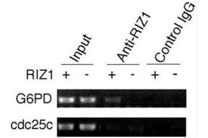 Image no. 5 for anti-PR Domain Containing 2, with ZNF Domain (PRDM2) (AA 1-347) antibody (ABIN3032300)