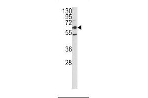 Western blot analysis of CEACAM antibody in HepG2 cell line lysates (35ug/lane) (CEACAM5 Antikörper  (N-Term))