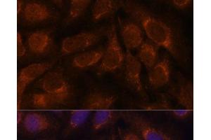 Immunofluorescence analysis of U-2 OS cells using CREB3 Polyclonal Antibody at dilution of 1:100. (CREB3 Antikörper)