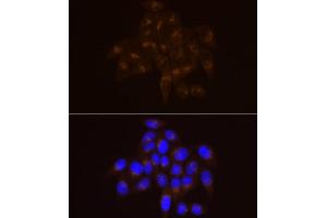 Immunofluorescence analysis of HeLa cells using USO1 Rabbit mAb (ABIN7271234) at dilution of 1:100 (40x lens). (USO1 Antikörper)