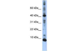 WB Suggested Anti-LSM6 Antibody Titration:  0. (LSM6 Antikörper  (N-Term))