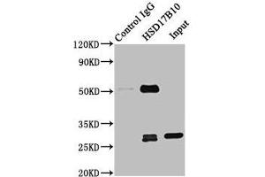 Immunoprecipitating HSD17B10 in 293T whole cell lysate Lane 1: Rabbit control IgG instead of ABIN7142296 in 293T whole cell lysate. (HSD17B1 Antikörper  (AA 2-261))