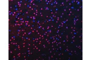 IF analysis of RBM22 using anti-RBM22 antibody (ABIN7600268). (RBM22 Antikörper  (AA 17-406))