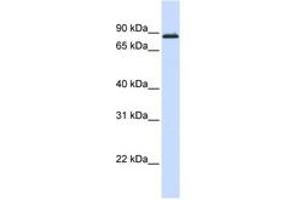 Image no. 1 for anti-Myb-Like Protein 1 (MYBL1) (AA 648-697) antibody (ABIN6743559) (MYBL1 Antikörper  (AA 648-697))