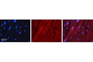 Rabbit Anti-NKX2-5 Antibody Catalog Number: ARP31575_P050 Formalin Fixed Paraffin Embedded Tissue: Human Heart Muscle Tissue Observed Staining: Nucleus Primary Antibody Concentration: 1:100 Other Working Concentrations: 1:600 Secondary Antibody: Donkey anti-Rabbit-Cy3 Secondary Antibody Concentration: 1:200 Magnification: 20X Exposure Time: 0. (NK2 Homeobox 5 Antikörper  (N-Term))
