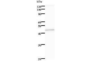 Western Blotting (WB) image for anti-serine/threonine Kinase 38 Like (STK38L) antibody (ABIN931250) (STK38L Antikörper)