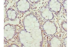 Immunohistochemistry (IHC) image for anti-Glucosaminyl (N-Acetyl) Transferase 2, I-Branching Enzyme (I Blood Group) (GCNT2) (AA 203-402) antibody (ABIN7160702)