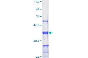 Image no. 1 for Tumor Protein P63 (TP63) (AA 1-100) protein (GST tag) (ABIN1323402) (p63 Protein (AA 1-100) (GST tag))