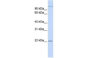 PDS5B antibody used at 1 ug/ml to detect target protein.