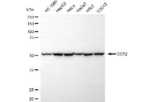 anti-Chaperonin Containing TCP1, Subunit 2 (Beta) (CCT2) antibody